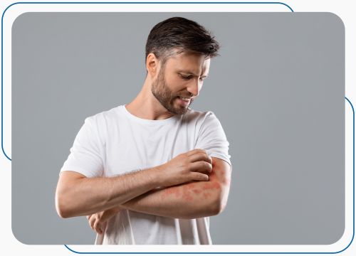 Allergies Treatment at Prima Urgent Care in Fairfax, VA Allergies Treatment at Prima Urgent Care in Fairfax, VA