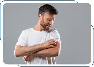 Allergies Treatment at Prima Urgent Care in Fairfax, VA Allergies Treatment at Prima Urgent Care in Fairfax, VA